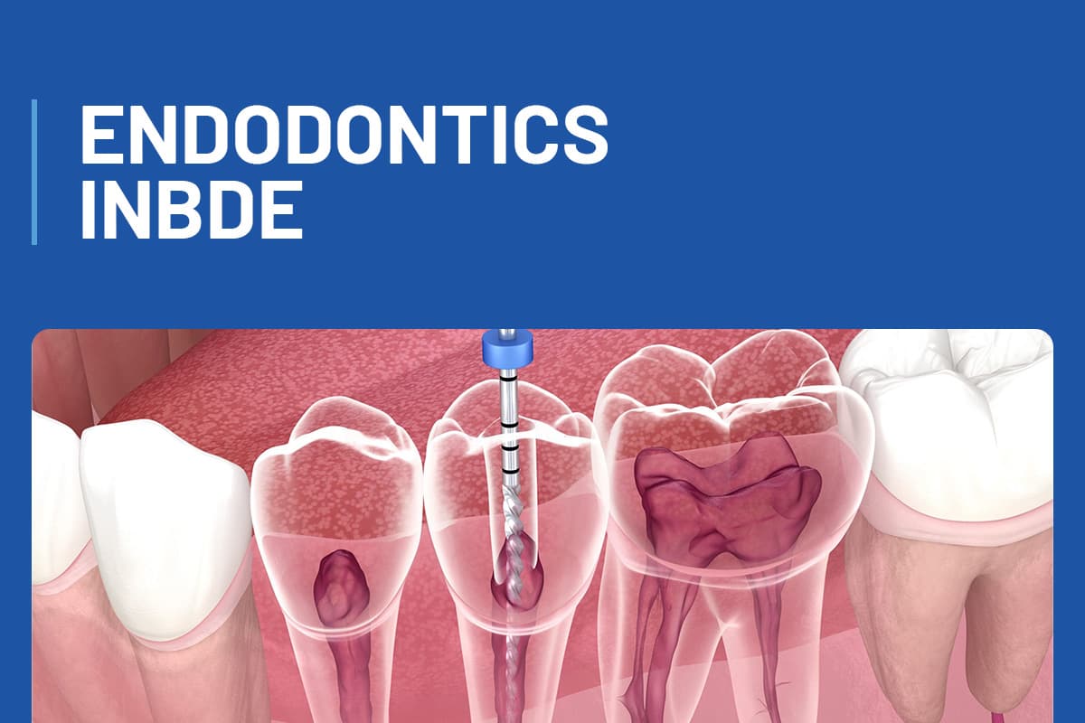 INBDE - Endodontics 
