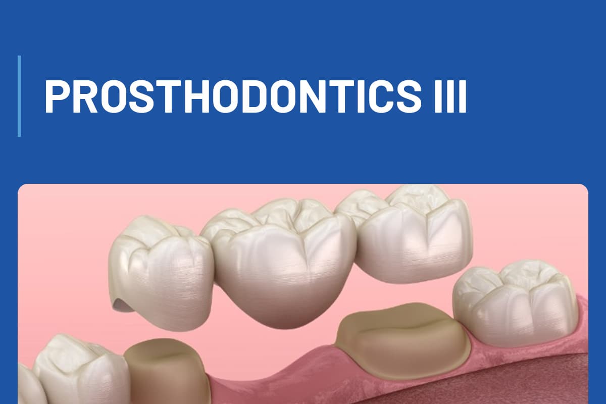 4.3 INBDE - Prosthodontics III