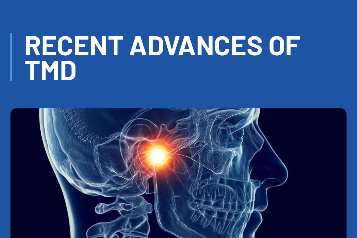 Recent Advances of TMD