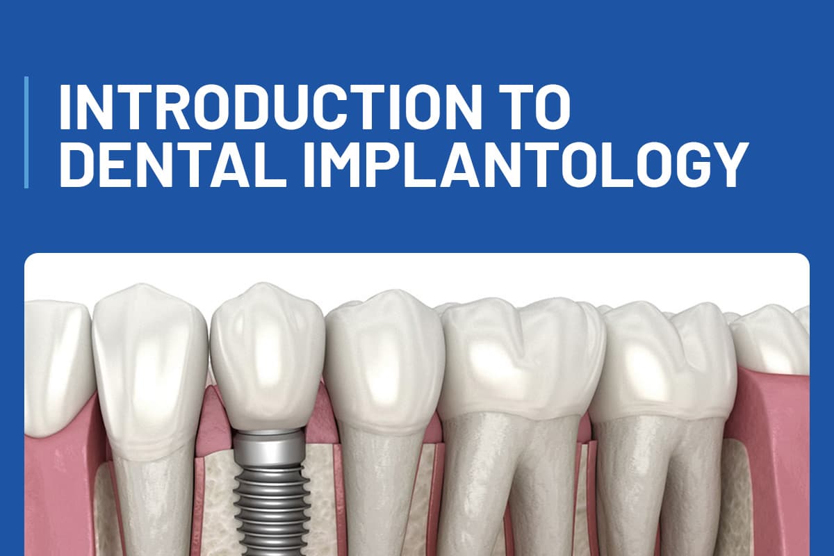 Introduction To Dental Implants