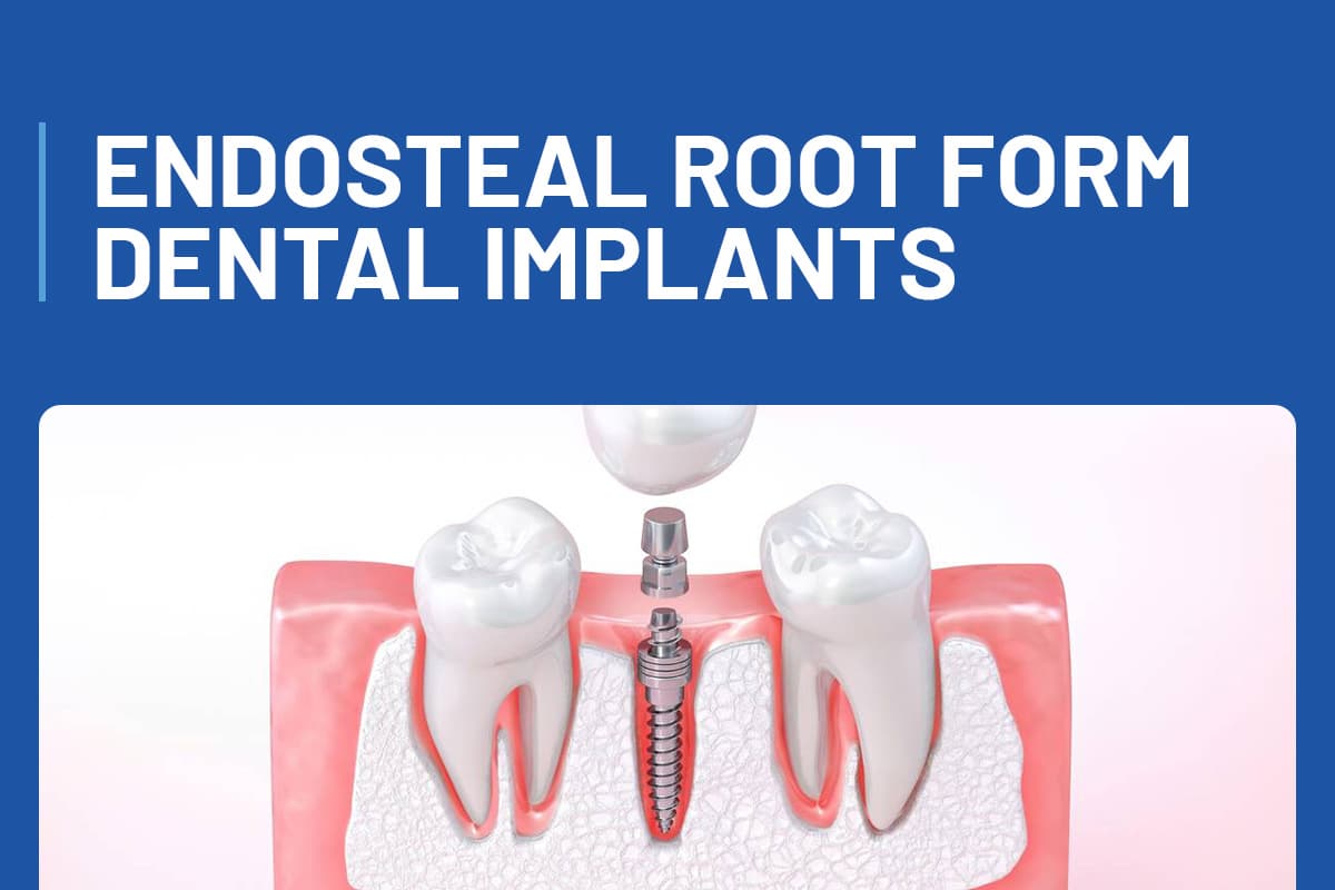 Endosteal Root Form Implants