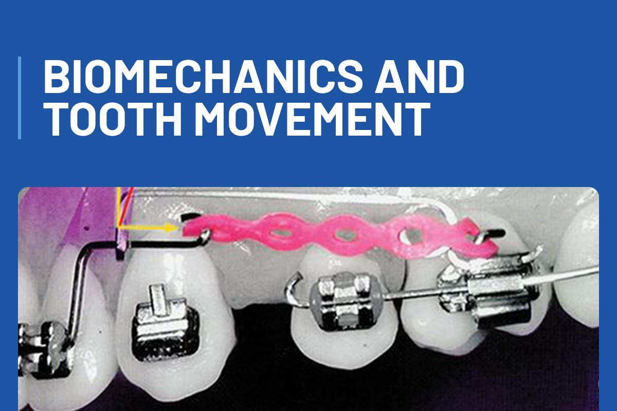 Biomechanics and Tooth Movement