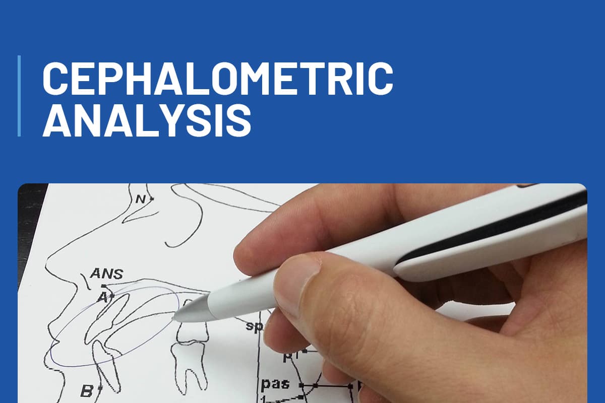Cephalometric Analysis + Workshop