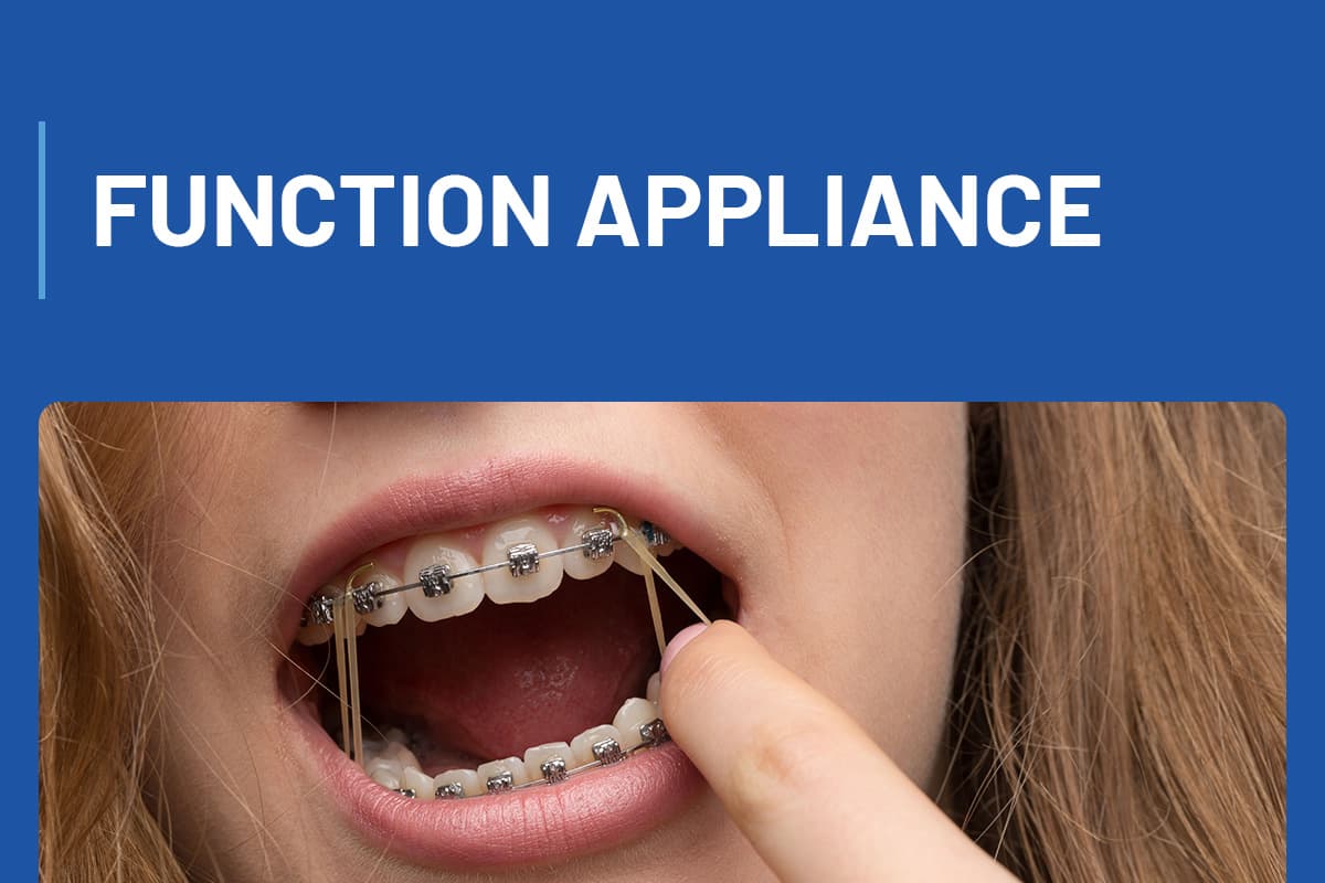 Function Appliance