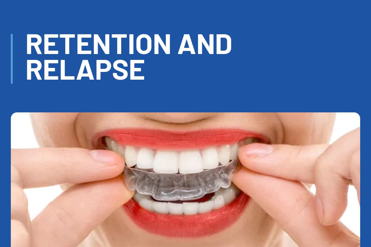 Retention and Relapse