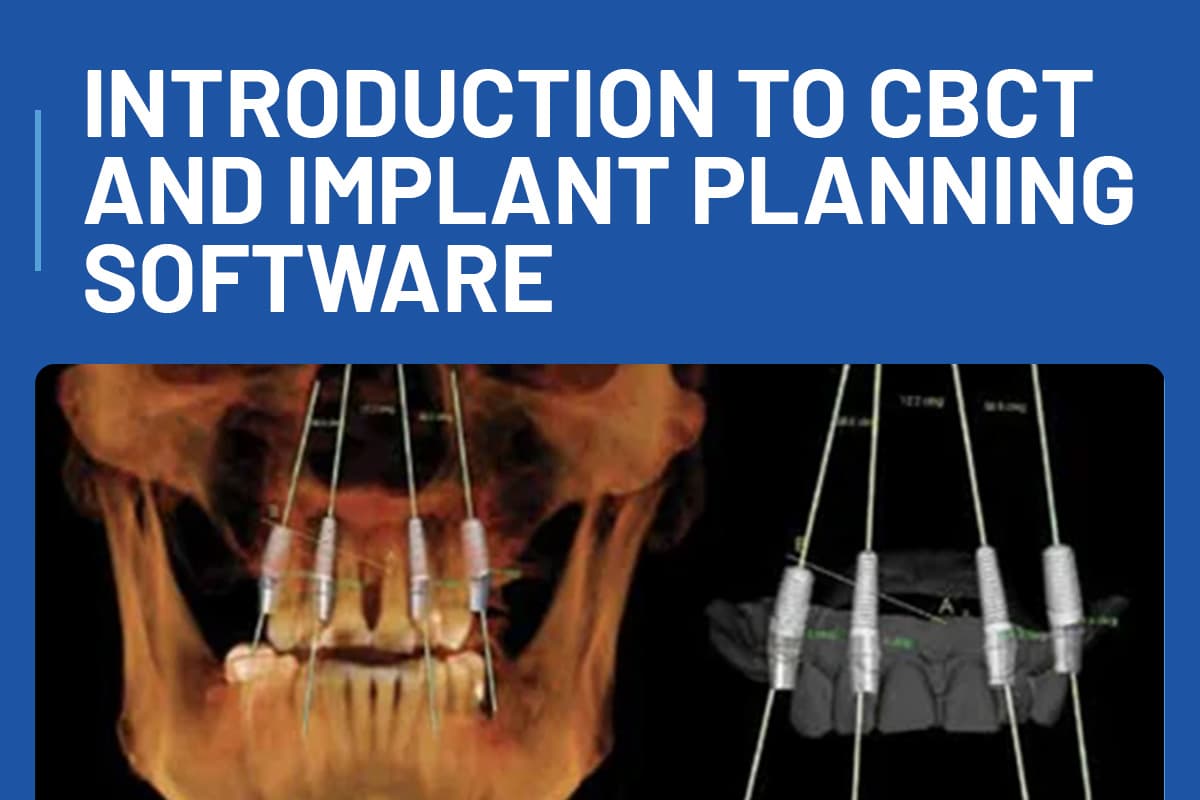 Introduction to CBCT and Implant Planning Software + Workshop