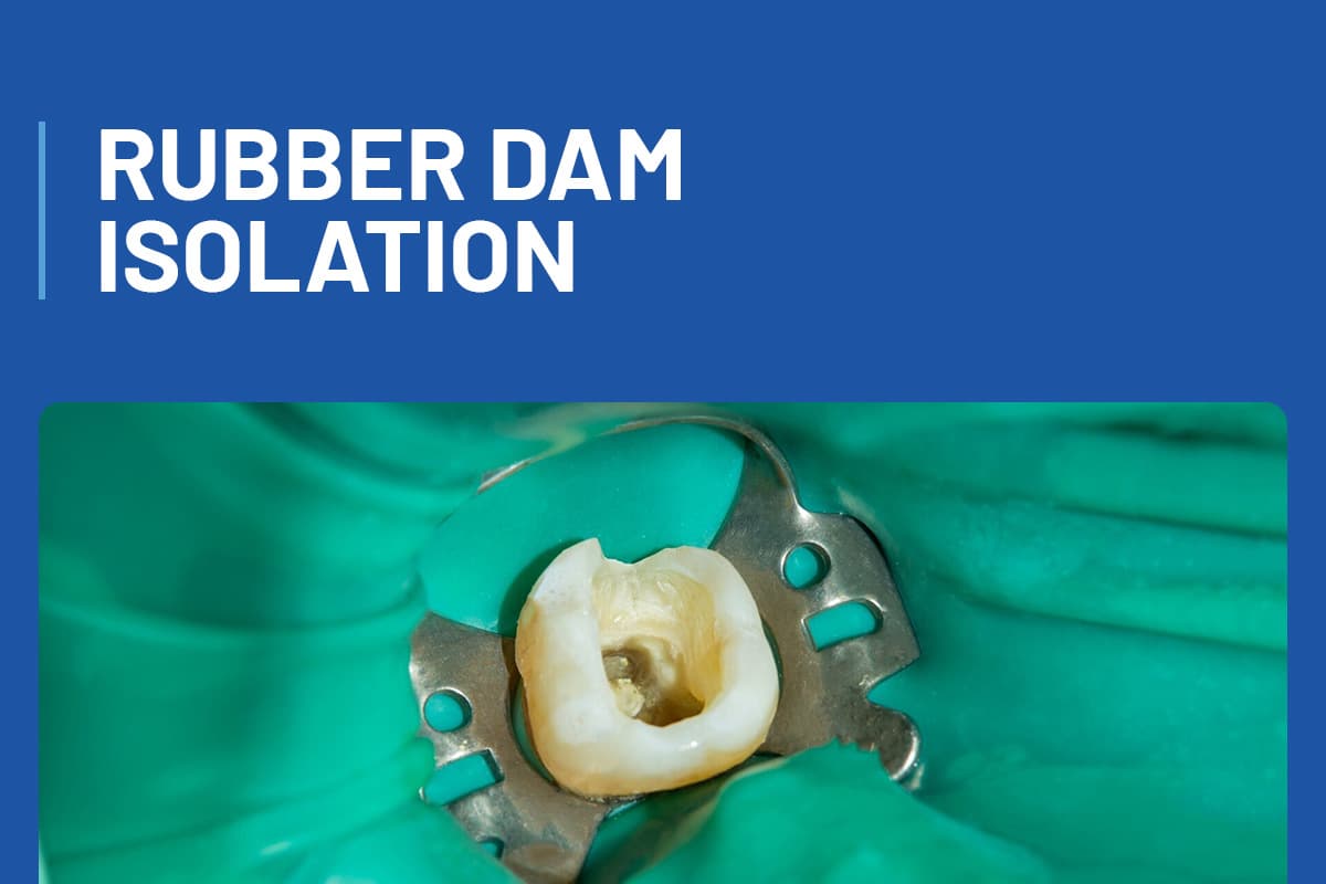 Rubber Dam Isolation