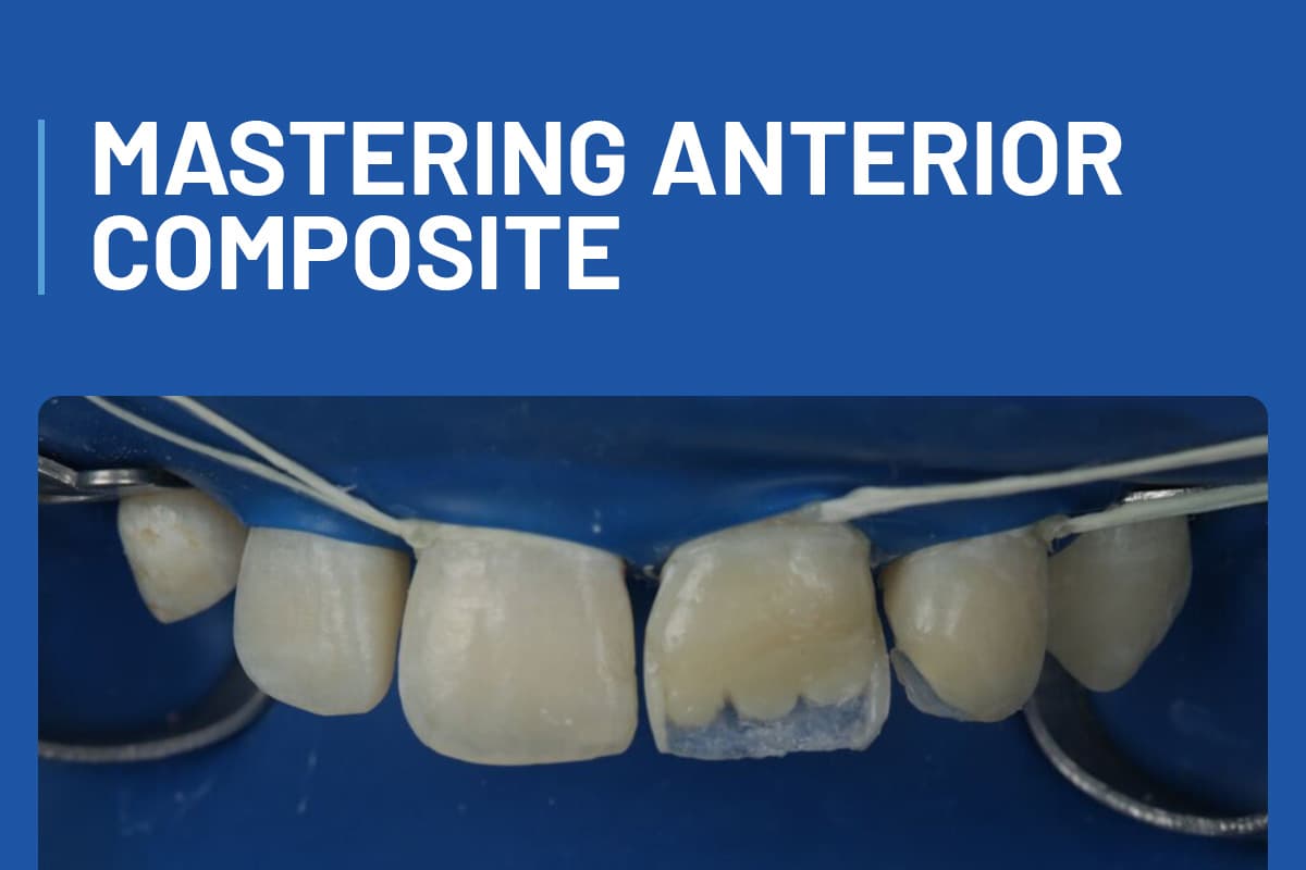 Mastering Anterior Composite + Workshop