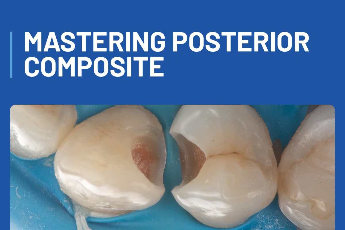Mastering Posterior Composite Restorations