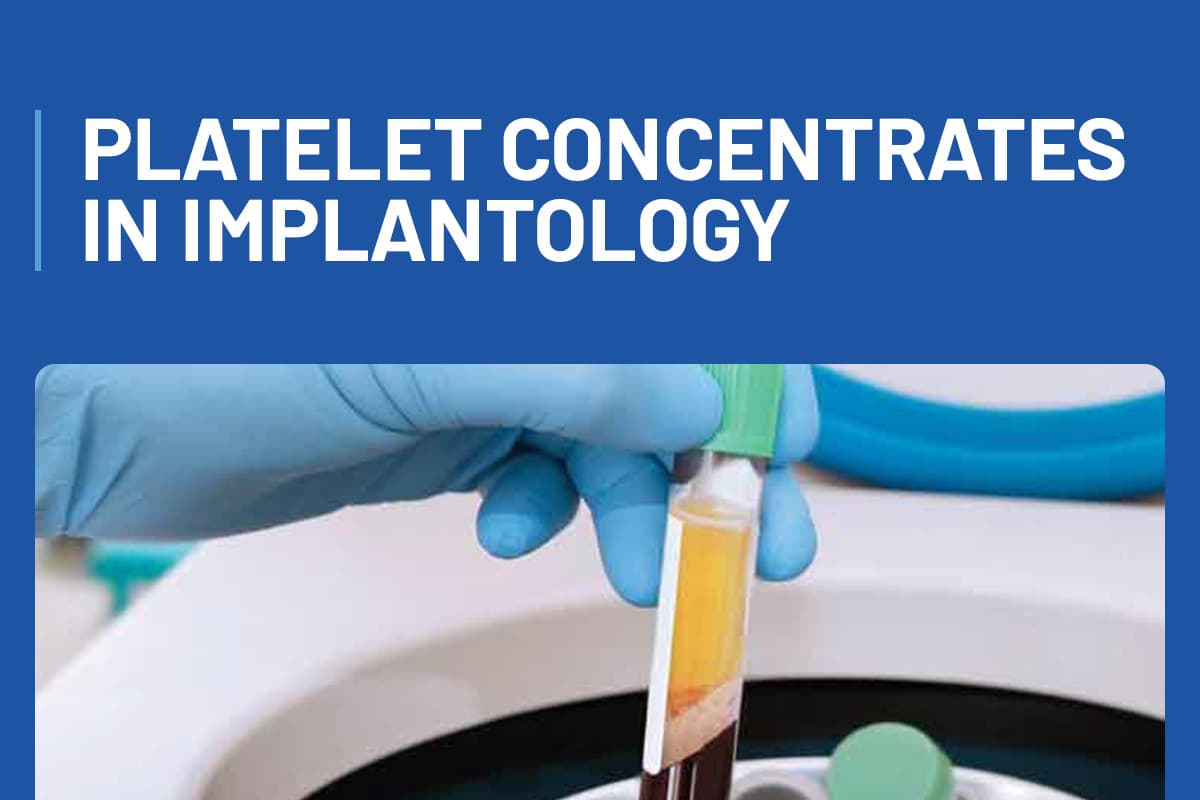 Platelet concentrates in Implantology + Live Demo