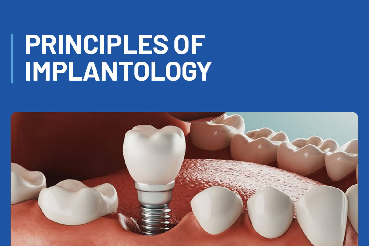 Principles of Implantology
