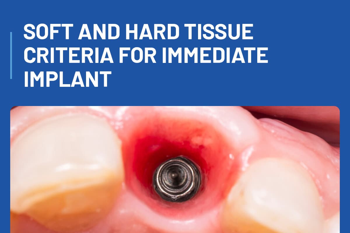 Soft and Hard Tissue Criteria for immediate Implant