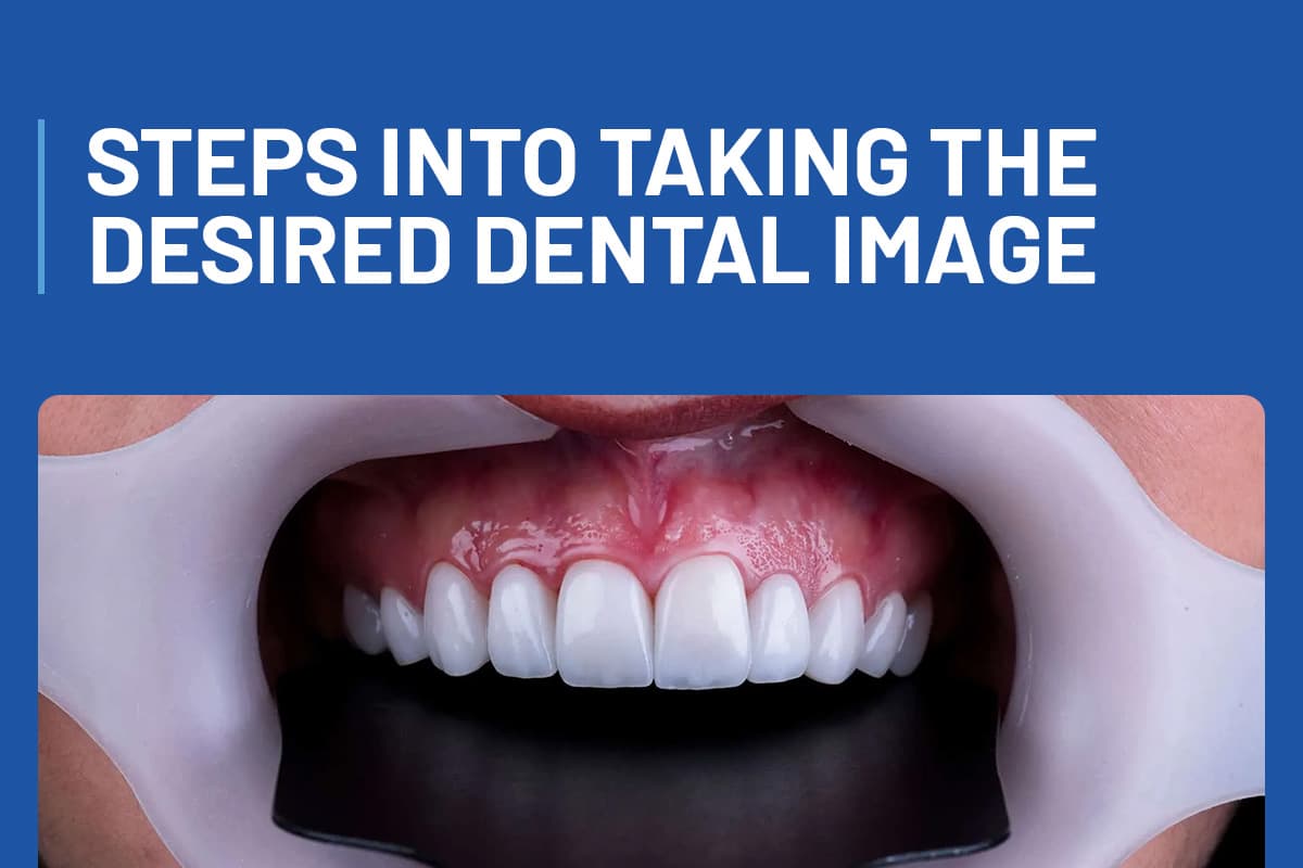 Steps Into Taking The Desired Dental Image