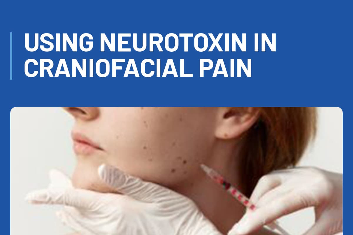 Using Neurotoxin in Craniofacial Pain