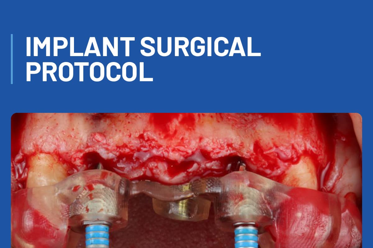 Implant Surgical Protocol