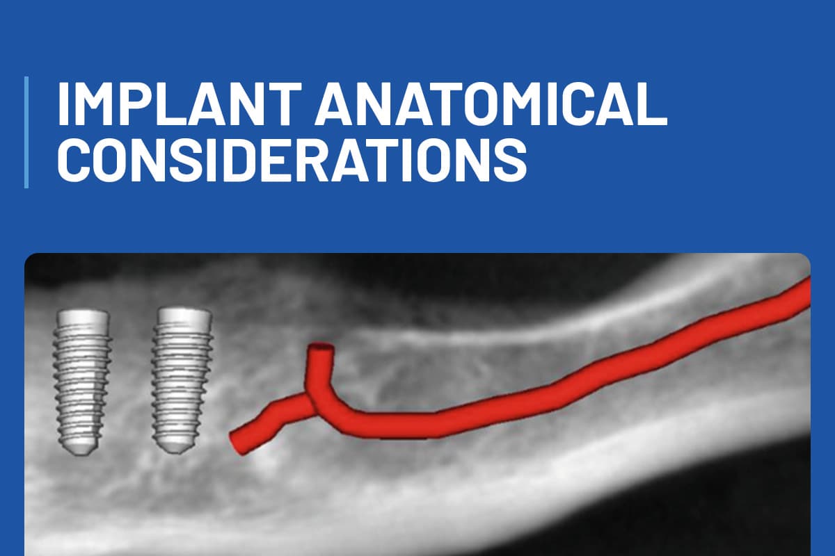 Implant Anatomical Considerations